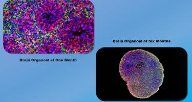 Developing brain organoid