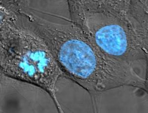 Blue-stained HeLa cells.  Credit: TenofAllTrades