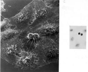 HeLa cells dividing under electron microscopy. Credit: NIH